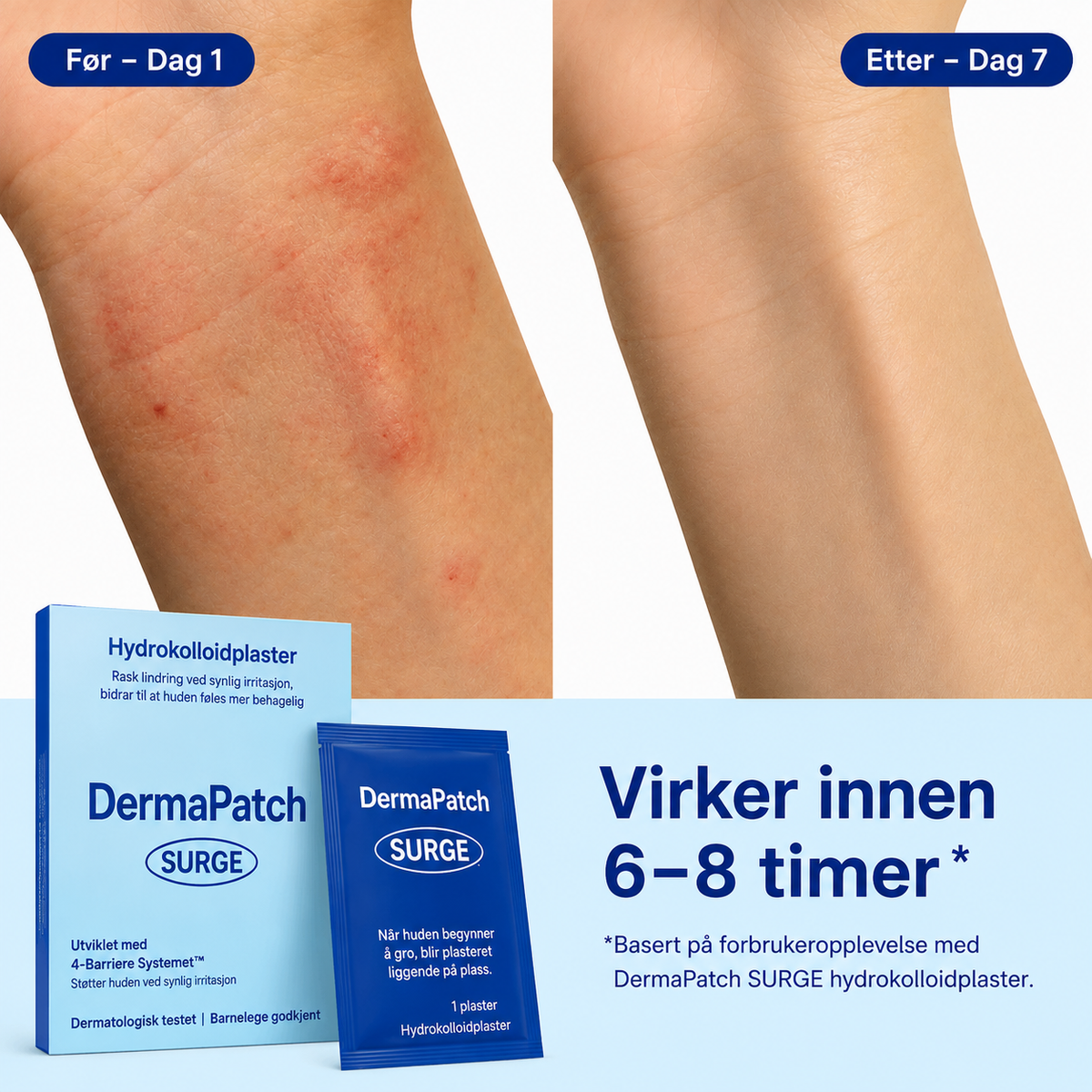Transparent hudplaster til tør og eksemudsat hud