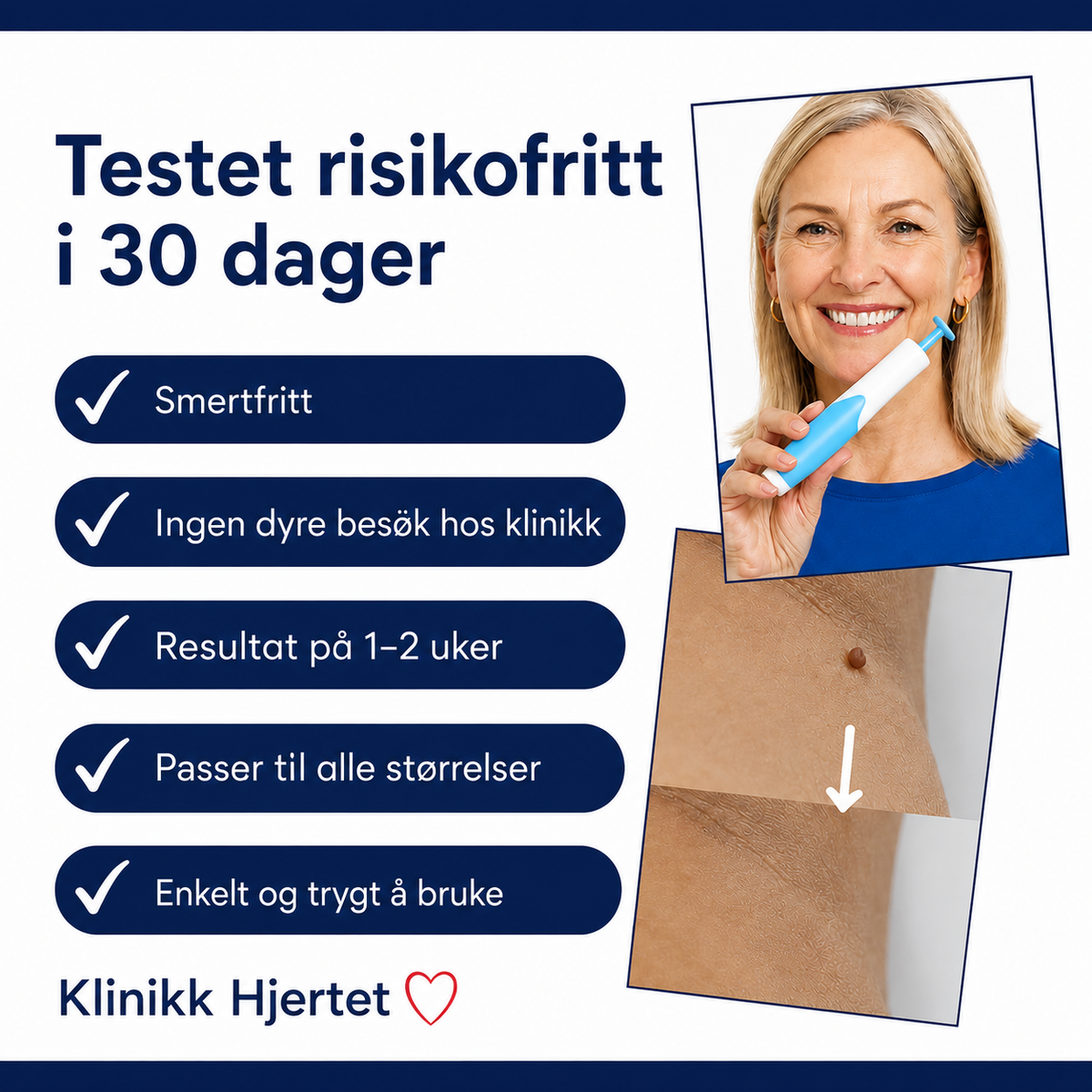Hudfligfjerner til hjemmebrug – komplet sæt til målrettet påføring